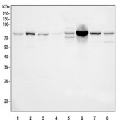 Western blot testing of 1) A549, 2) RT4, 3) HepG2, 4) A431, 5) rat liver, 6) rat kidney, 7) mouse liver and 8) mouse kidney tissue lysate with GCLC antibody. Predicted molecular weight ~72 kDa.