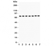 Western blot testing of GCLC antibody and Lane 1:  rat brain;  2: (r) heart;  3: human HeLa;  4: (r) PC12;  5: (r) NRK;  6: mouse HEPA;  7: (h) A549.  Predicted/observed size ~72KD