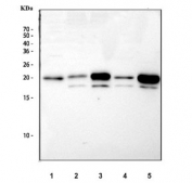 Western blot testing 1) human ThP-1, 2) rat lung, 3) rat liver, 4) mouse lung and 5) mouse liver lysate with GPX1 antibody. Predicted molecular weight ~22 kDa.