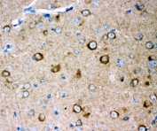 IHC staining of FFPE mouse brain with GLUR2 antibody. HIER: boil tissue sections in pH6, 10mM citrate buffer, for 10-20 min and allow to cool before testing.