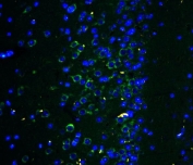 Immunofluorescent staining of FFPE mouse brain tissue with GLUR2 antibody (green) and DAPI nuclear stain (blue). HIER: steam section in pH6 citrate buffer for 20 min.