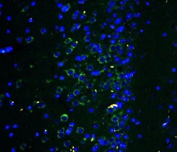 Immunofluorescent staining of FFPE mouse brain tissue with GLUR2 antibody (green) and DAPI nuclear stain (blue). HIER: steam section in pH6 citrate buffer for 20 min.