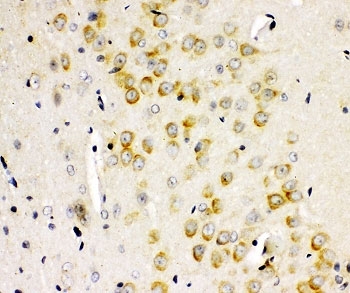 IHC staining of FFPE rat brain with GLUR2 antibody. HIER: boil tissue sections in pH6, 10mM citrate buffer, for 10-20 min and allow to cool before testing.