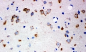 IHC staining of frozen rat brain tissue with GLUR2 antibody.