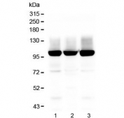 Western blot testing of 1) rat brain, 2) rat C6 and 3) mouse brain lysate with GLUR2 antibody.  Predicted molecular weight ~99 kDa.
