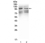 Western blot testing of 1) rat brain and 2) mouse brain lysate with GRIK1 antibody. Predicted molecular weight: ~104/150+ kDa (unmodified/glycosylated).