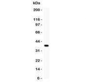 Western blot testing of GRIK1 antibody and recombinant human protein (0.5ng)