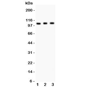 Western blot testing of GRIK1 antibody and Lane 1: mouse brain; 2: mouse brain; 3: human SHG-44 (glioma) lysate. Predicted/observed size ~104KD