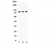Western blot testing of GRIK1 antibody and Lane 1:  mouse brain;  2: mouse brain;  3: human SHG-44 (glioma) lysate.  Predicted molecular weight: ~104/150+ kDa (unmodified/glycosylated).