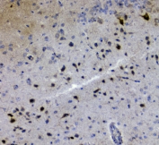 IHC staining of FFPE mouse brain with GRIK1 antibody at 1ug/ml. HIER: boil tissue sections in pH6, 10mM citrate buffer, for 10-20 min and allow to cool before testing.
