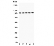 Western blot testing of HCN1 antibody and Lane 1:  rat brain;  2: mouse brain;  3: human HeLa;  4: (h) U87;  5: (h) MCF-7 lysate.  Predicted/observed size ~99KD