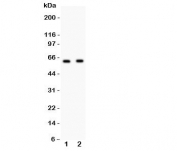 Western blot testing of HEXB antibody and Lane 1:  HeLa;  2: HEPG2 lysate. Predicted/observed size ~63KD