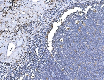 IHC staining of FFPE human tonsil tissue with HO-1 antibody. HIER: boil tissue sections in pH8 EDTA for 20 min and allow to cool before testing.~