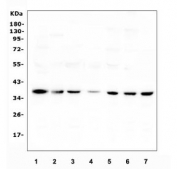 Western blot testing of human 1) A549, 2) Caco-2, 3) HEK293, 4) Jurkat, 5) HepG2, 6) K562 and 7) Raji cell lysate with Heme Oxygenase 2 antibody. Predicted molecular weight ~36 kDa.