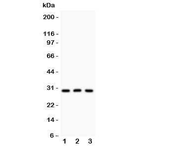 Western blot testing of HOXA9 antibody and Lane 1: rat testis; 2: human HEPG2; 3: mouse HEPA lysate. Expected/observed size ~30KD~