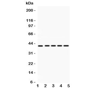 Western blot testing of HOXA10 antibody and Lane 1: rat kidney; 2: human placenta; 3: (h) HeLa; 4: (h) SW620; 5: mouse HEPA lysate~