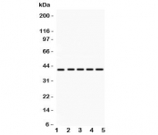Western blot testing of HOXA10 antibody and Lane 1:  rat kidney;  2: human placenta;  3: (h) HeLa;  4: (h) SW620;  5: mouse HEPA lysate. Predicted molecular weight: ~42kDa.