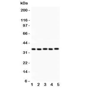 Western blot testing of HOXA11 antibody and Lane 1: rat brain; 2: human placenta; 3: human HeLa; 4: (h) HT1080; 5: mouse HEPA lysate. Expected/observed size ~35KD