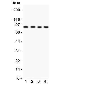 Western blot testing of IKKb antibody and human lysates- Lane 1: HEPG2; 2: COLO320; 3: M231; 4: HT1080 lysate. Expected molecular weight: ~87 kDa.