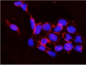 Immunofluorescent staining of FFPE human A431 cells with IKKb antibody (red) and DAPI nuclear stain (blue). HIER: steam section in pH6 citrate buffer for 20 min.