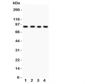 Western blot testing of IKKb antibody and human lysates- Lane 1:  HEPG2;  2: COLO320;  3: M231;  4: HT1080 lysate.  Expected molecular weight: ~87 kDa.