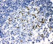 IHC-P: IRF4 antibody testing of human tonsil tissue.