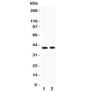 Western blot testing of IRF4 antibody and Lane 1:  HeLa;  2: Jurkat lysate;  Predicted molecular weight ~51 kDa, observed here at ~40 kDa.