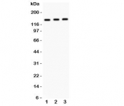 Western blot testing of IRS1 antibody and Lane 1:  A549;  2: MM453;  3: Jurkat.  Expected size: 132~185KD depending on serine phosphorylation level