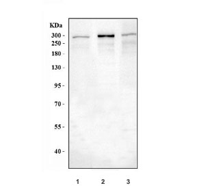 Western blot testing of 1) human HeLa, 2) rat brain and 3) mouse brain lysate with IP3R antibody at 1ug/ml. Predicted molecular weight ~314 kDa.