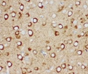 IHC-P: IP3R antibody testing of mouse brain tissue. HIER: steam section in pH6 citrate buffer for 20 min.