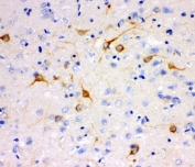 IHC-P testing of rat brain tissue. HIER: steam section in pH6 citrate buffer for 20 min.