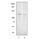 Western blot testing of human 1) PC-3 and 2) U-87 MG cell lysate with BK channel antibody. Predicted molecular weight: 130-140 kDa (multiple isoforms).