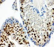 IHC-P: MCAK antibody testing of mouse testis tissue