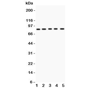 Western blot testing of MCAK antibody and Lane 1: mouse testis; 2: human HeLa; 3: (h) MM231; 4: (h) MM453; 5: (h) SKOV lysate. Predicted molecular weight ~81 kDa.
