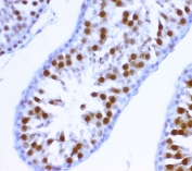 IHC-P: MCAK antibody testing of rat testis tissue