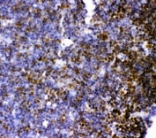 IHC-P: MCAK antibody testing of rat thymus tissue