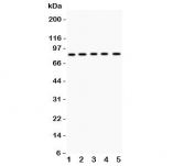 Western blot testing of MCAK antibody and Lane 1:  mouse testis;  2: human HeLa;  3: (h) MM231;  4: (h) MM453;  5: (h) SKOV lysate.  Predicted molecular weight 76-81 kDa.
