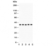 Western blot testing of KLF6 antibody and Lane 1:  human placenta;  2: rat testis;  3: (h) HeLa;  4: (h) HEPG2;  5: mouse HEPA lysate.  Expected size: 32~40KD
