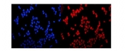 Immunofluorescent staining of FFPE human MCF7 cells with Glucocorticoid receptor antibody (red) and DAPI nuclear stain (blue). HIER: steam section in pH6 citrate buffer for 20 min.