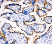 IHC staining of FFPE human placenta with Transferrin Receptor antibody. HIER: boil tissue sections in pH6, 10mM citrate buffer, for 20 min and allow to cool before testing.