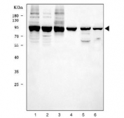 Western blot testing of 1) human HeLa, 2) human K562, 3) human HT1080, 4) rat thymus, 5) mouse RAW264.7 and 6) mouse SP2/0 cell lysate with Transferrin Receptor antibody. Predicted molecular weight 85~95 kDa.