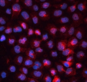 Immunofluorescent staining of FFPE human A431 cells with Transferrin Receptor antibody (red) and DAPI nuclear stain (blue). HIER: boil tissue sections in pH6, 10mM citrate buffer, for 20 min and allow to cool before testing.