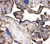 IHC staining of frozen human placenta with Transferrin Receptor antibody. HIER: boil tissue sections in pH6, 10mM citrate buffer, for 20 min and allow to cool before testing.