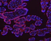 Immunofluorescent staining of FFPE human placental tissue with Transferrin Receptor antibody (red) and DAPI nuclear stain (blue). HIER: boil tissue sections in pH8 EDTA buffer for 20 min and allow to cool before testing.