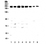 Western blot testing of human 1) A431, 2) Caco-2, 3) U-2 OS, 4) K562, 5) PC3, 6) T-47D, 7) rat ovary and 8) mouse ovary lysate with ZO-1 antibody. Predicted/observed molecular weight: ~194 kDa.
