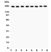 Western blot testing of ZO-1 antibody and Lane 1:  rat liver;  2: mouse liver;  3: (r) NRK;  4: (r) PC12;  5: human HeLa;  6: (h) SMMC-7721;  7: (m) HEPA;  8: (h) COLO320 lysate.  Predicted molecular weight: ~194 kDa.