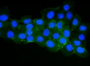 Immunofluorescent staining of FFPE human A431 cells with ZO-1 antibody (green) and DAPI nuclear stain (blue). HIER: steam section in pH6 citrate buffer for 20 min.