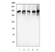 Western blot testing of 1) human PC-3, 2) human Caco-2, 3) human COLO-320, 4) rat testis and 5) mouse testis tissue lysate with ZO-1 antibody. Predicted molecular weight: ~194 kDa.