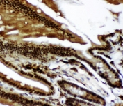 IHC-P: p73 antibody testing of mouse intestine tissue