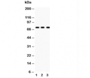 Western blot testing of p73 antibody and Lane 1:  COLO320;  2: MCF-7;  3: HeLa lysate